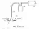 Fig. 02 - Negative pressure device