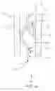 Fig. 06 - Recirculation minimizing catheter