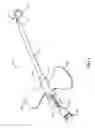 Fig. 02 - Systems And Methods For Venipuncture And Catheter Placement