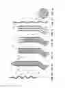 Fig. 02 - Medical microelectrode, method for its manufacture, and use thereof