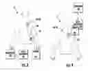 Fig. 03 - DEVICES, SYSTEMS, AND METHODS FOR TREATING CARDIAC ARRHYTHMIAS