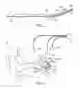 Fig. 06 - Cochlear implant localization system
