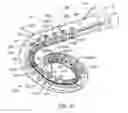 Fig. 09 - Cochlear implant localization system