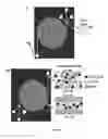 Fig. 02 - Fluidic device for the detection, capture, or removal of a disease material
