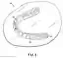 Fig. 04 - Laser cutting