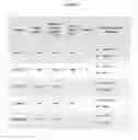 Fig. 20 - Anti-B7-H4 antibodies and immunoconjugates