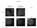 Fig. 21 - Anti-B7-H4 antibodies and immunoconjugates