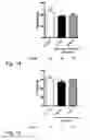 Fig. 28 - Treatment of diseases by liver expression of an enzyme which has a deoxyribonuclease (DNase) activity