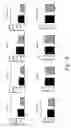 Fig. 29 - Treatment of diseases by liver expression of an enzyme which has a deoxyribonuclease (DNase) activity