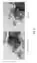 Fig. 35 - Treatment of diseases by liver expression of an enzyme which has a deoxyribonuclease (DNase) activity
