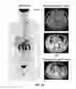Fig. 09 - BIOMARKER FOR PREDICTING RESPONSIVENESS TO ANTICANCER AGENT FOR GASTRIC CANCER AND USE THEREOF