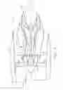 Fig. 02 - Turbine engine blade with leading edge strip