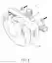 Fig. 02 - Fixing structure for protective cover of valve assembly