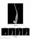 Fig. 07 - Capture, identification and use of a new biomarker of solid tumors in body fluids