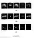 Fig. 09 - Capture, identification and use of a new biomarker of solid tumors in body fluids