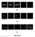 Fig. 11 - Capture, identification and use of a new biomarker of solid tumors in body fluids