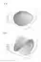 Fig. 17 - Lens for astigmatism