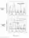Fig. 12 - Mask pattern verification method