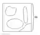 Fig. 01 - Determining respiratory phase from fluoroscopic images