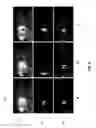 Fig. 07 - Relevant motion detection in video