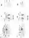 Fig. 04 - Channel strain inducing architecture and doping technique at replacement poly gate (RPG) stage