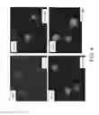 Fig. 08 - Platelet Storage and Reduced Bacterial Proliferation In Platelet Products Using A Sialidase Inhibitor