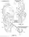 Fig. 04 - Protective sports guard