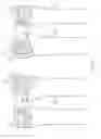 Fig. 05 - SUPPORT-PROVIDING COATING METHOD AND APPARATUS