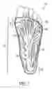 Fig. 02 - Anatomical support method using elongate strap support
