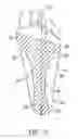 Fig. 13 - Anatomical support method using elongate strap support