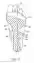 Fig. 18 - Anatomical support method using elongate strap support