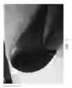 Fig. 18 - Sole structure for article of footwear