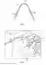 Fig. 05 - Slotted eyelet