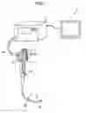 Fig. 02 - ENDOSCOPE SYSTEM AND ENDOSCOPE