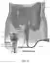 Fig. 07 - Alimentary engagement device