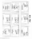 Fig. 149 - Bone reconstruction and orthopedic implants