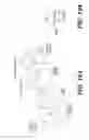 Fig. 158 - Bone reconstruction and orthopedic implants