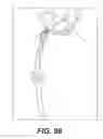 Fig. 79 - Bone reconstruction and orthopedic implants