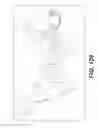 Fig. 87 - Bone reconstruction and orthopedic implants