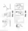 Fig. 89 - Bone reconstruction and orthopedic implants
