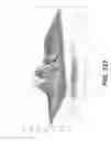 Fig. 99 - Bone reconstruction and orthopedic implants