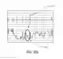 Fig. 24 - Apparatus and method for catheter navigation using endovascular energy mapping