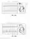 Fig. 30 - Apparatus and method for catheter navigation using endovascular energy mapping