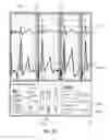 Fig. 41 - Apparatus and method for catheter navigation using endovascular energy mapping