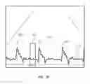 Fig. 47 - Apparatus and method for catheter navigation using endovascular energy mapping