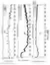 Fig. 45 - Sensor systems, devices, and methods for continuous glucose monitoring