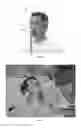 Fig. 02 - Detection of tissue damage