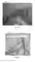 Fig. 04 - Detection of tissue damage