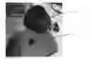 Fig. 01 - PORTABLE APPARATUS FOR IMAGING THE EYE