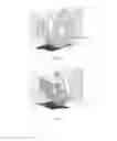 Fig. 07 - PORTABLE APPARATUS FOR IMAGING THE EYE
